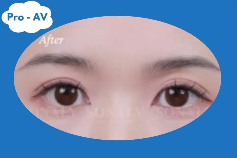 Sonaly Beauty Spa - nối mi Lạng Sơn